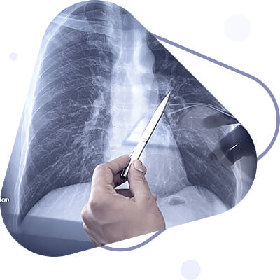 Suppurative lung diseases